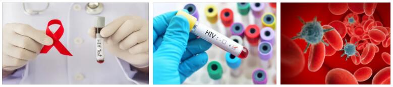 HIV Diagnostics and Reactions